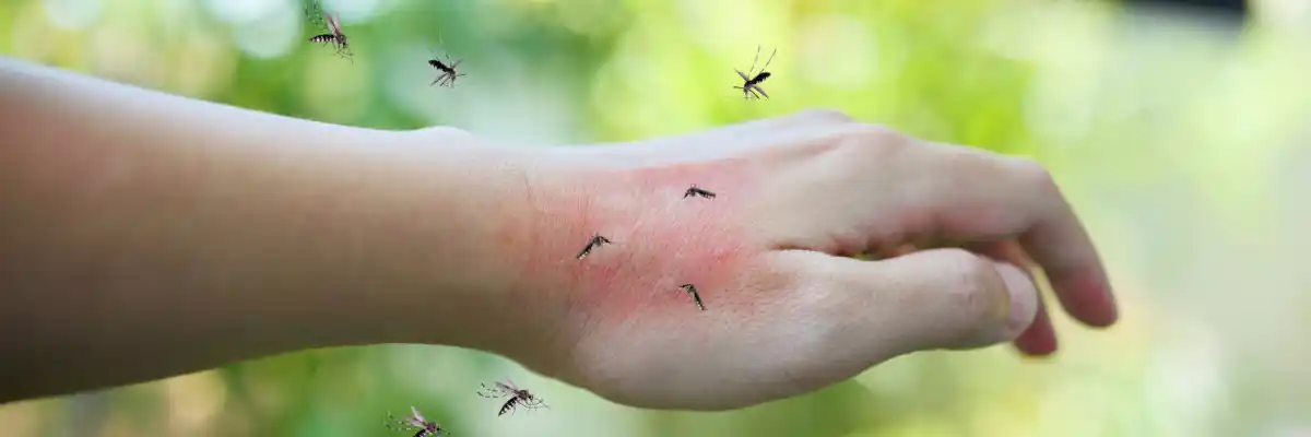 mosquito bite pest control fl
